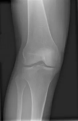 Orthopedic Surgery Board Review 2026 | High-Yield MCQs - Set 7 - Figure 69