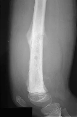 Orthopedic Surgery Board Review 2026 | High-Yield MCQs - Set 7 - Figure 72