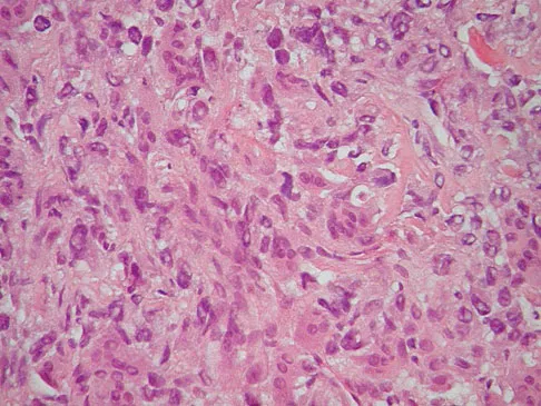 Orthopedic Surgery Board Review 2026 | High-Yield MCQs - Set 7 - Figure 74