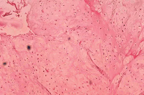 Orthopedic Surgery Board Review 2026 | High-Yield MCQs - Set 7 - Figure 76