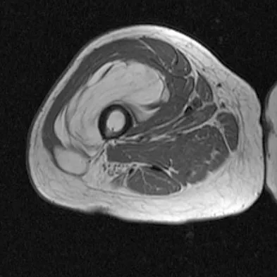 Orthopedic Surgery Board Review 2026 | High-Yield MCQs - Set 7 - Figure 80