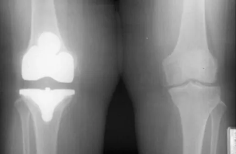 Orthopedic Surgery Board Review 2026 | High-Yield MCQs - Set 7 - Figure 86