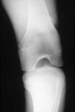 Orthopedic Surgery Board Review 2026 | High-Yield MCQs - Set 7 - Figure 9