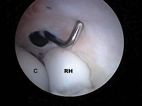 Orthopedic Surgery Board Review 2026 | High-Yield MCQs - Set 7 - Figure 90