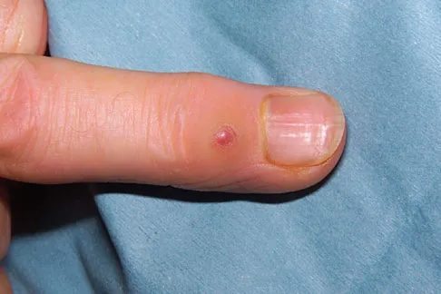 Orthopedic Surgery Board Review 2026 | High-Yield MCQs - Set 7 - Figure 91