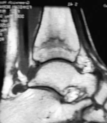 Orthopedic Surgery Board Review 2026 | High-Yield MCQs - Set 7 - Figure 93
