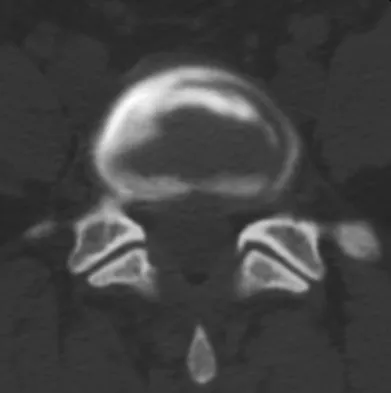 Orthopedic Surgery Board Review 2026 | High-Yield MCQs - Set 8 - Figure 114