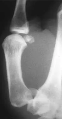 Orthopedic Surgery Board Review 2026 | High-Yield MCQs - Set 8 - Figure 116