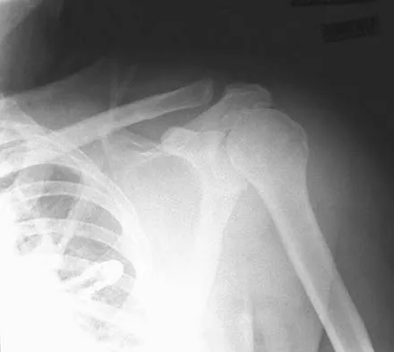 Orthopedic Surgery Board Review 2026 | High-Yield MCQs - Set 8 - Figure 118