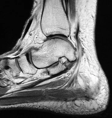 Orthopedic Surgery Board Review 2026 | High-Yield MCQs - Set 8 - Figure 13