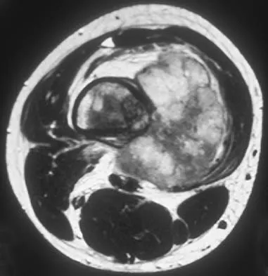 Orthopedic Surgery Board Review 2026 | High-Yield MCQs - Set 8 - Figure 18