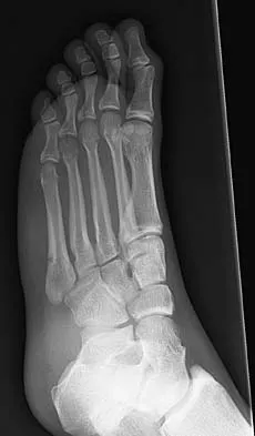 Orthopedic Surgery Board Review 2026 | High-Yield MCQs - Set 8 - Figure 21