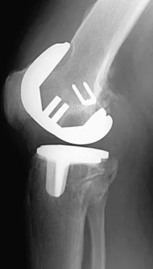 Orthopedic Surgery Board Review 2026 | High-Yield MCQs - Set 8 - Figure 28