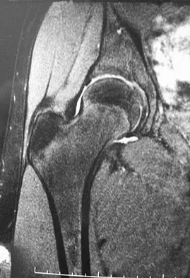 Orthopedic Surgery Board Review 2026 | High-Yield MCQs - Set 8 - Figure 58