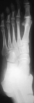 Orthopedic Surgery Board Review 2026 | High-Yield MCQs - Set 8 - Figure 61