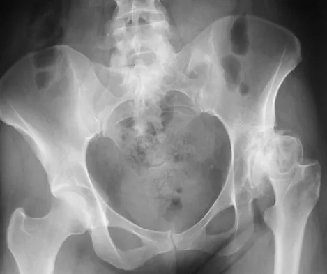 Orthopedic Surgery Board Review 2026 | High-Yield MCQs - Set 8 - Figure 7