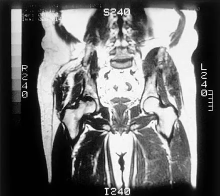 Orthopedic Surgery Board Review 2026 | High-Yield MCQs - Set 8 - Figure 72