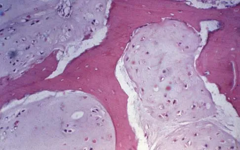 Orthopedic Surgery Board Review 2026 | High-Yield MCQs - Set 8 - Figure 76