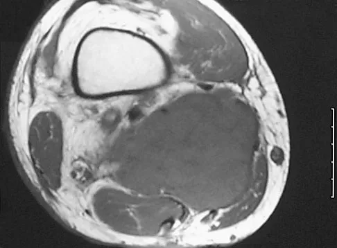 Orthopedic Surgery Board Review 2026 | High-Yield MCQs - Set 8 - Figure 8