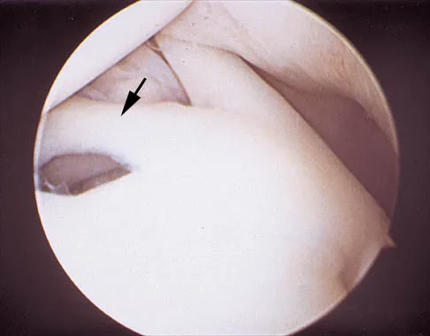 Orthopedic Surgery Board Review 2026 | High-Yield MCQs - Set 8 - Figure 82