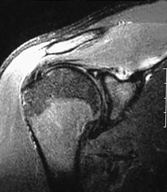 Orthopedic Surgery Board Review 2026 | High-Yield MCQs - Set 8 - Figure 87