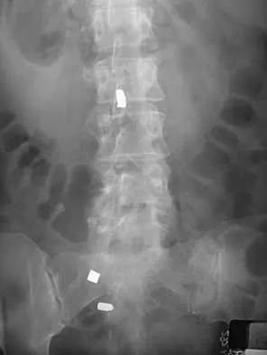 Orthopedic Surgery Board Review 2026 | High-Yield MCQs - Set 8 - Figure 93
