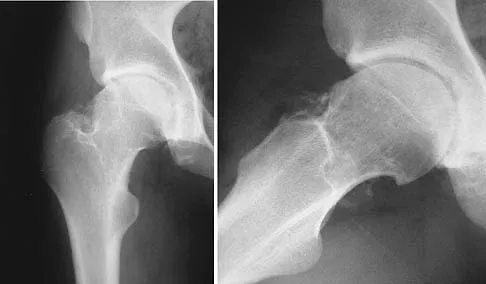 Orthopedic Surgery Board Review 2026 | High-Yield MCQs - Set 8 - Figure 96