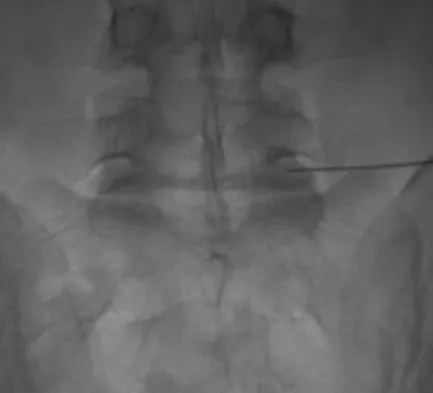 Orthopedic Surgery Board Review 2026 | High-Yield MCQs - Set 9 - Figure 112
