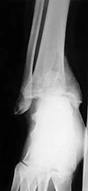 Orthopedic Surgery Board Review 2026 | High-Yield MCQs - Set 9 - Figure 114