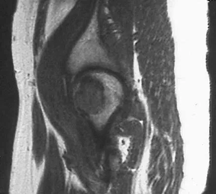 Orthopedic Surgery Board Review 2026 | High-Yield MCQs - Set 9 - Figure 12