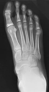 Orthopedic Surgery Board Review 2026 | High-Yield MCQs - Set 9 - Figure 15