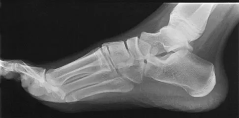 Orthopedic Surgery Board Review 2026 | High-Yield MCQs - Set 9 - Figure 16