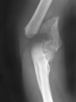 Orthopedic Surgery Board Review 2026 | High-Yield MCQs - Set 9 - Figure 19