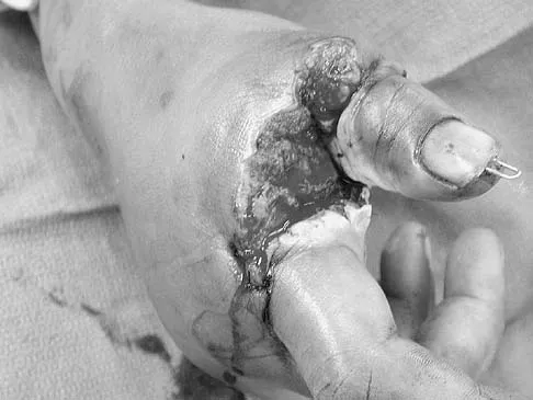 Orthopedic Surgery Board Review 2026 | High-Yield MCQs - Set 9 - Figure 3