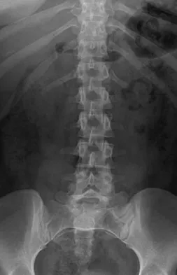 Orthopedic Surgery Board Review 2026 | High-Yield MCQs - Set 9 - Figure 36