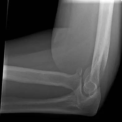 Orthopedic Surgery Board Review 2026 | High-Yield MCQs - Set 9 - Figure 48