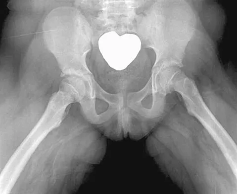 Orthopedic Surgery Board Review 2026 | High-Yield MCQs - Set 9 - Figure 59