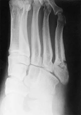 Orthopedic Surgery Board Review 2026 | High-Yield MCQs - Set 9 - Figure 9