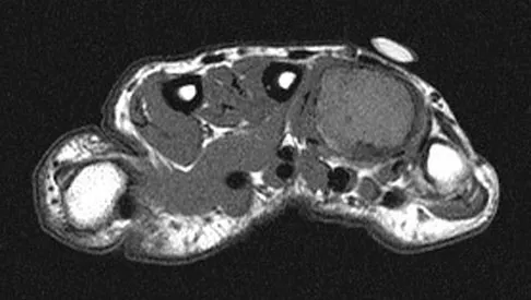 Orthopedic Surgery Board Review 2026 | High-Yield MCQs - Set 9 - Figure 90