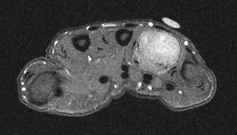 Orthopedic Surgery Board Review 2026 | High-Yield MCQs - Set 9 - Figure 92