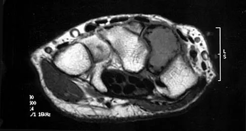 Orthopedic Surgery Board Review 2026 | High-Yield MCQs - Set 9 - Figure 98
