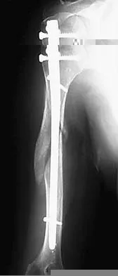 Orthopedic Trauma 2026 MCQs: Board Review Questions & Answers (Part 1) - Figure 2