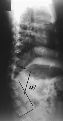 Pediatrics 2001 Practice Questions: Set 1 (Solved) - Figure 16