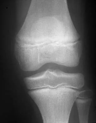 Pediatrics 2001 Practice Questions: Set 1 (Solved) - Figure 17