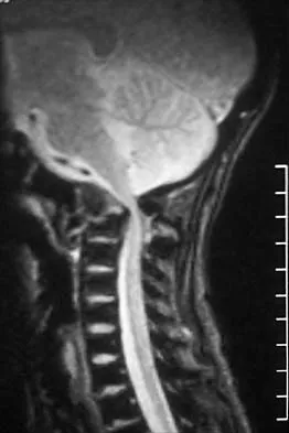 Pediatrics 2001 Practice Questions: Set 1 (Solved) - Figure 27