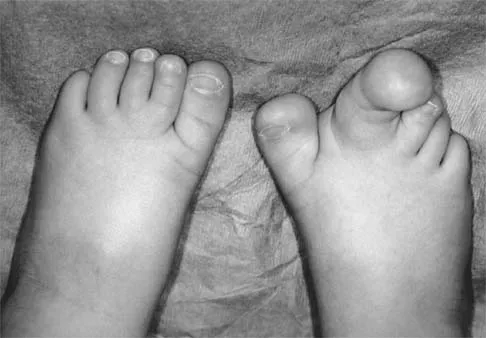 Pediatrics 2001 Practice Questions: Set 1 (Solved) - Figure 4