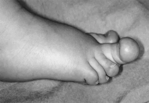 Pediatrics 2001 Practice Questions: Set 1 (Solved) - Figure 5