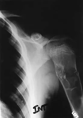 Pediatrics Board Review 2001: High-Yield MCQs (Set 2) - Figure 15