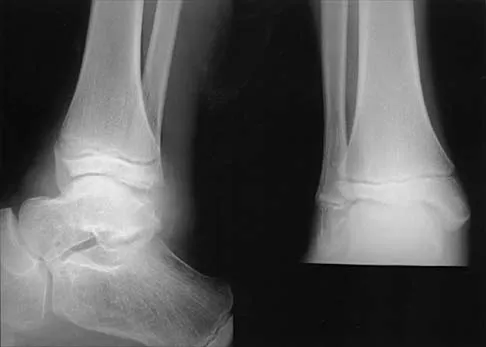 Pediatrics Board Review 2001: High-Yield MCQs (Set 2) - Figure 2