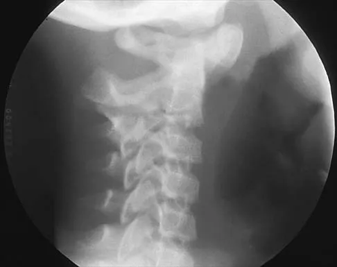Pediatrics Board Review 2001: High-Yield MCQs (Set 2) - Figure 4